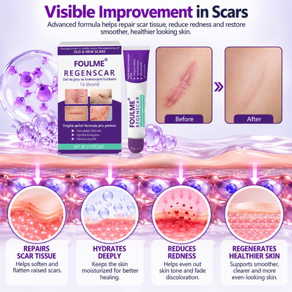 ReGenScar Advanced Scar Repair Gel