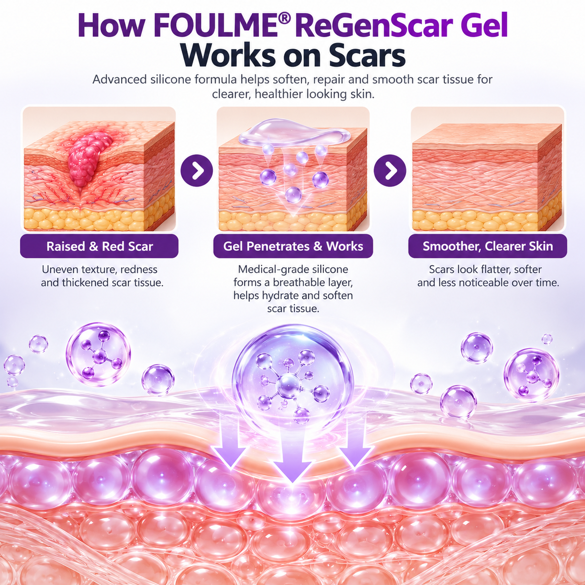 ReGenScar Advanced Scar Repair Gel