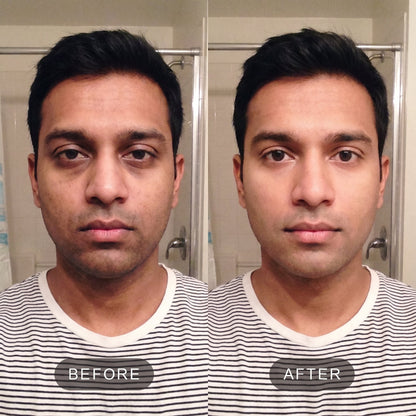 VITA Serum Shot