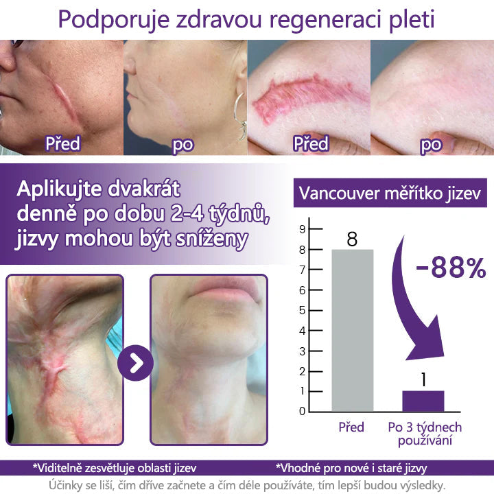 ReGenScar Advanced Scar Repair Gel